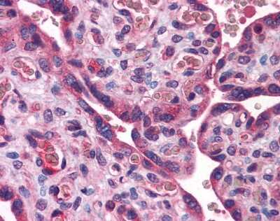 Immunohistochemistry: ACSL1 Antibody [NBP1-60016]