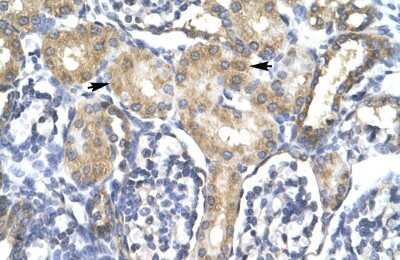 Immunohistochemistry-Paraffin: ACSL1 Antibody [NBP1-60016]