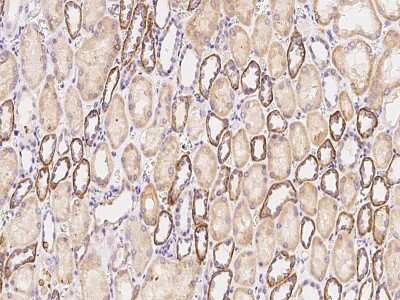 Immunohistochemistry-Paraffin: ACSL1 Antibody [NBP2-99339]