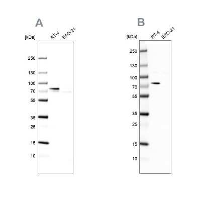 Western Blot: ACSL1 Antibody [NBP1-89270]