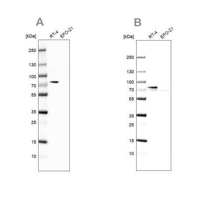 Western Blot: ACSL1 Antibody [NBP1-89271]