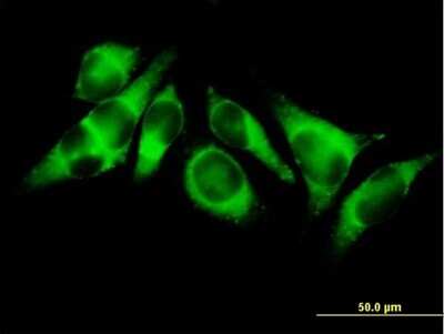 Immunocytochemistry/ Immunofluorescence: ACSL3 Antibody [H00002181-B01P]
