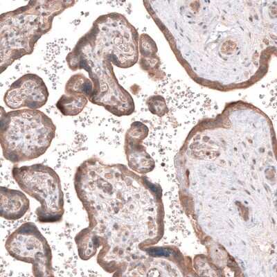 Immunohistochemistry-Paraffin: ACSL3 Antibody [NBP1-89268]