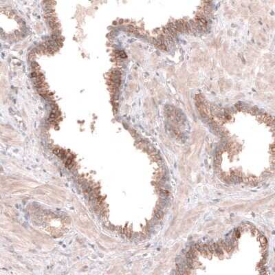 Immunohistochemistry-Paraffin: ACSL3 Antibody [NBP1-89268]