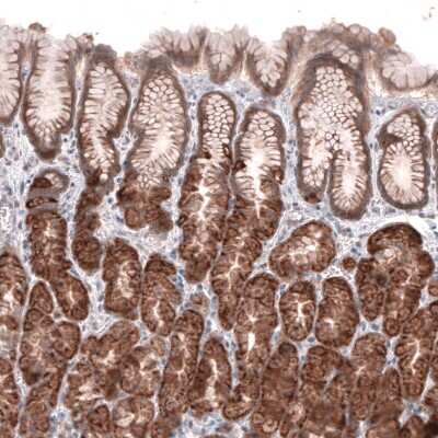 Immunohistochemistry-Paraffin: ACSL3 Antibody [NBP1-89268]