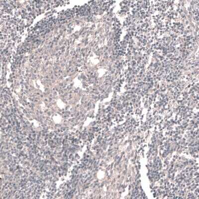 Immunohistochemistry-Paraffin: ACSL3 Antibody [NBP1-89268]