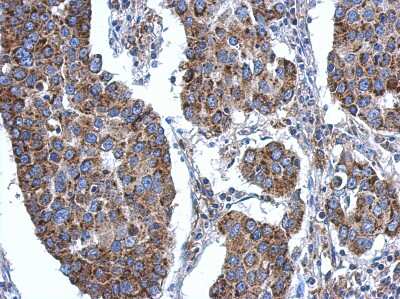 Immunohistochemistry-Paraffin: ACSL3 Antibody [NBP2-15252]