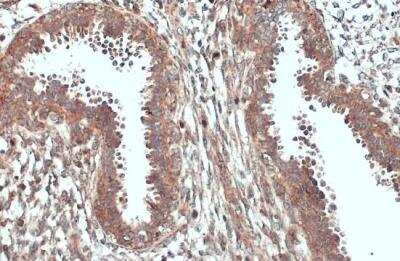 Immunohistochemistry-Paraffin: ACSL3 Antibody [NBP2-15252]