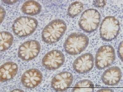 Immunohistochemistry-Paraffin: ACSL5 Antibody (5H8) [H00051703-M01]
