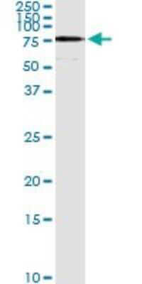 Immunoprecipitation: ACSL5 Antibody (5H8) [H00051703-M01]
