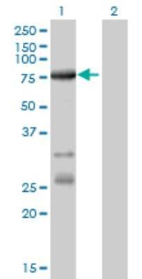 Western Blot: ACSL5 Antibody (5H8) [H00051703-M01]