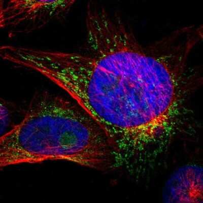 Immunocytochemistry/ Immunofluorescence: ACSL5 Antibody [NBP2-31995]