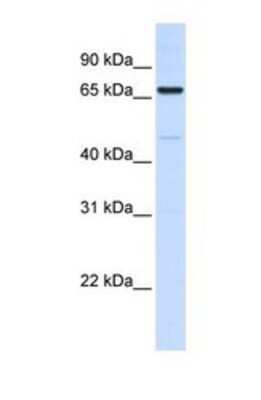 Western Blot: ACSL5 Antibody [NBP1-59645]