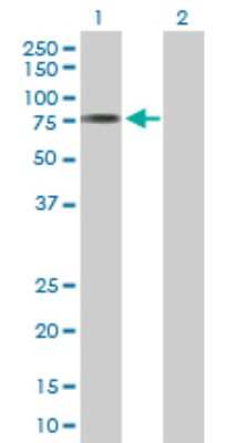 Western Blot: ACSM3 Antibody [H00006296-D01P]