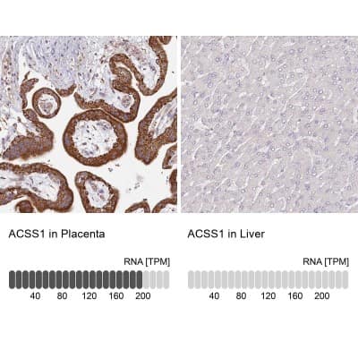 Immunohistochemistry-Paraffin: ACSS1 Antibody [NBP2-30635]