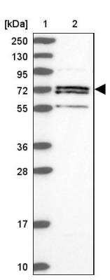 Western Blot: ACSS1 Antibody [NBP2-30612]