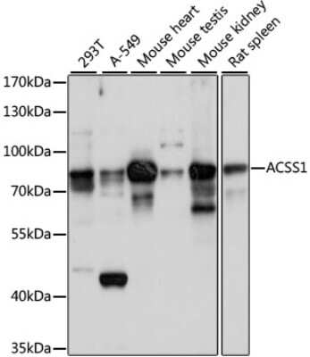 Western Blot: ACSS1 AntibodyAzide and BSA Free [NBP2-92202]