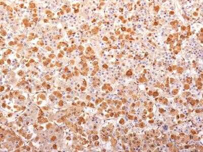 Immunohistochemistry-Paraffin: ACTH Antibody (AH26 + 57) - N-terminal [NBP2-34284]