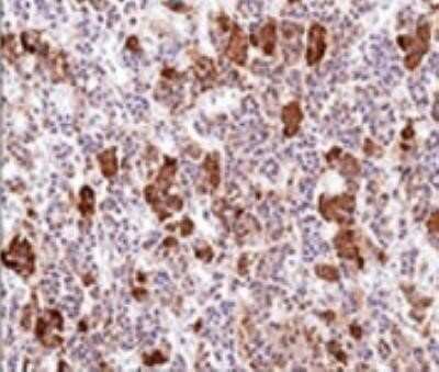 Immunohistochemistry-Paraffin: ACTH Antibody (AH26) - Azide and BSA Free [NBP2-33072]