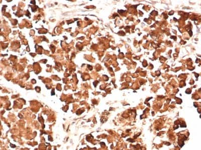 Immunohistochemistry-Paraffin: ACTH Antibody (AH26) [NBP2-29452]