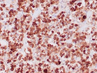 Immunohistochemistry-Paraffin: ACTH Antibody (CLIP/1407) [NBP2-47658]