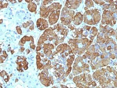 Immunohistochemistry-Paraffin: ACTH Antibody (CLIP/1449) - C-terminus [NBP2-53161]