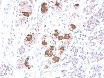 Immunohistochemistry-Paraffin: ACTH Antibody (CLIP/2040R) [NBP3-07627]