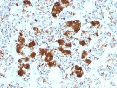 Immunohistochemistry-Paraffin: ACTH Antibody (SPM501) - C-terminus [NBP2-53160]