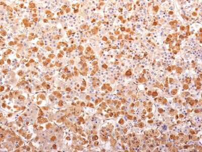 Immunohistochemistry-Paraffin: ACTH Antibody (r57) - N-terminal - Azide and BSA Free [NBP2-54342]