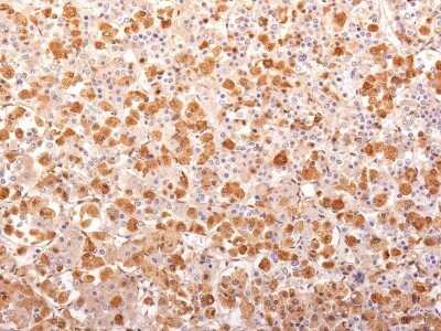 Immunohistochemistry-Paraffin: ACTH Antibody (r57) - N-terminal [NBP2-53156]