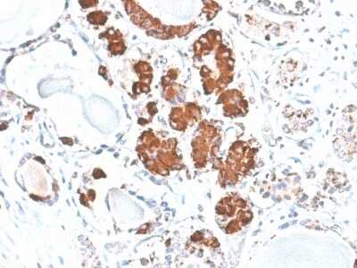 Immunohistochemistry-Paraffin: ACTH Antibody (rCLIP/1407) [NBP3-07626]