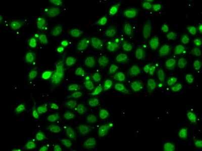 Immunocytochemistry/ Immunofluorescence: ACTL6B Antibody - BSA Free [NBP2-92909]