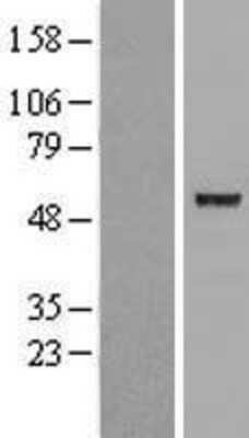 Western Blot: ACTL7A Overexpression Lysate [NBL1-07279]