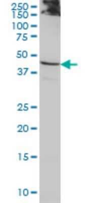 Western Blot: ACTL7B Antibody (6A4) [H00010880-M01]