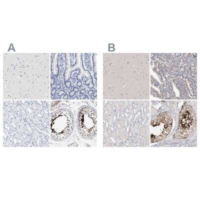 Immunohistochemistry-Paraffin: ACTL7B Antibody [NBP1-86973]