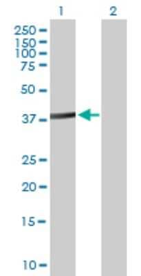 Western Blot: ACTL8 Antibody [H00081569-B01P]