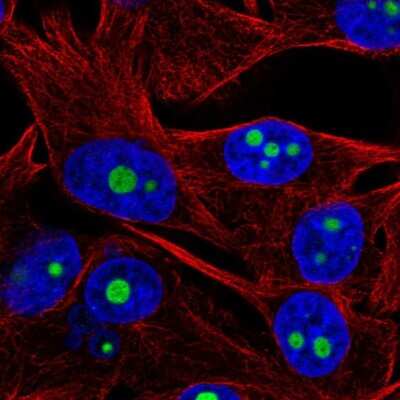 Immunocytochemistry/ Immunofluorescence: ACTR10 Antibody [NBP2-55963]