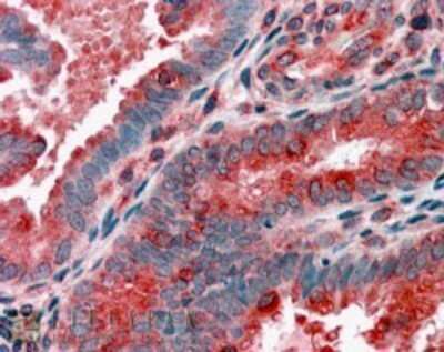 Immunohistochemistry: ACTR1B Antibody [NB100-1424]