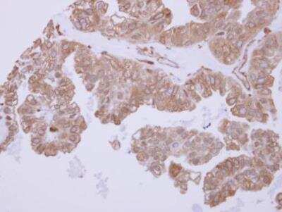 Immunohistochemistry-Paraffin: ACTR1B Antibody [NBP2-15275]