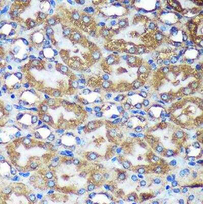 Immunohistochemistry-Paraffin: ACTR1B Antibody - Azide and BSA Free [NBP2-92261]