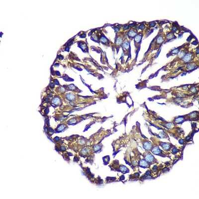 Immunohistochemistry-Paraffin: ACTR1B Antibody - Azide and BSA Free [NBP2-92261]