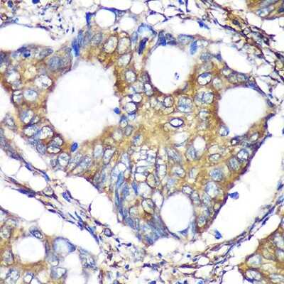 Immunohistochemistry-Paraffin: ACTR1B Antibody - Azide and BSA Free [NBP2-92261]