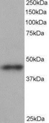 Western Blot: ACTR1B Antibody [NB100-1424]