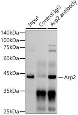 Immunoprecipitation: ACTR2 Antibody (6B1I3) [NBP3-16714]