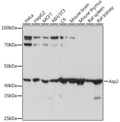 Western Blot: ACTR2 Antibody (6B1I3) [NBP3-16714]