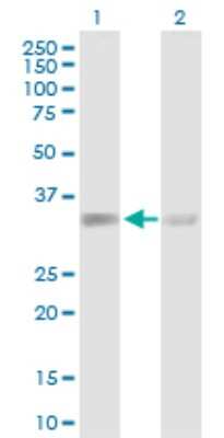 Western Blot: ACTR2 Antibody [H00010097-D01P]
