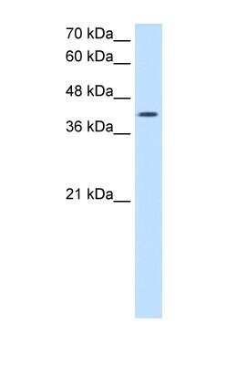 Western Blot: ACTR2 Antibody [NBP1-53201]