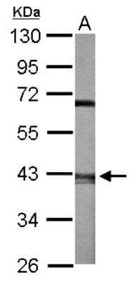 Western Blot: ACTR2 Antibody [NBP2-15276]