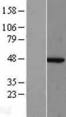 Western Blot: ACTR2 Overexpression Lysate [NBL1-07287]