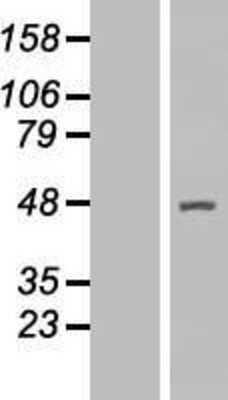 Western Blot: ACTR2 Overexpression Lysate [NBP2-08861]